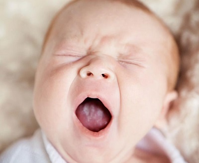 Молочница у новорожденного ребенка во рту